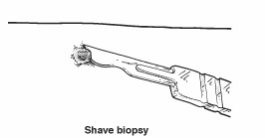 Soft Tissue Biopsy1