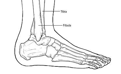 ankle fracture