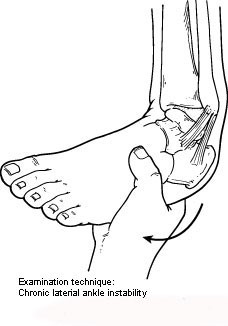 chronic ankle instability